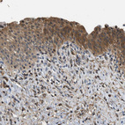 Immunohistochemical staining of human urinary bladder shows strong cytoplasmic positivity in urothelial cells.