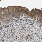 Immunohistochemical staining of human urinary bladder shows strong cytoplasmic positivity in urothelial cells.