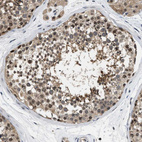 Immunohistochemical staining of human testis shows moderate cytoplasmic positivity in cells in seminiferous ducts.