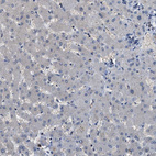 Immunohistochemical staining of human liver shows no positivity in hepatocytes as expected.