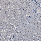 Immunohistochemical staining of human liver shows no positivity in hepatocytes as expected.