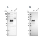 Western blot analysis using Anti-TES antibody HPA018123 (A) shows similar pattern to independent antibody HPA015269 (B).