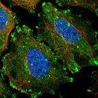 Immunofluorescent staining of human cell line SiHa shows localization to plasma membrane, cytosol & focal adhesion sites.