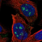 Immunofluorescent staining of human cell line U-2 OS shows localization to nucleoli.