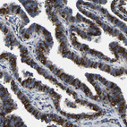 Immunohistochemical staining of human Fallopian tube shows strong membranous positivity in glandular cells.