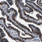 Immunohistochemical staining of human Fallopian tube shows strong membranous positivity in glandular cells.