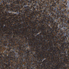 Immunohistochemical staining of human tonsil shows strong membranous positivity in non-germinal center cells.