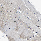 Immunohistochemical staining of human skeletal muscle shows very weak positivity in myocytes.