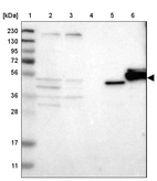 Lane 1: Marker [kDa] 230, 130, 95, 72, 56, 36, 28, 17, 11_br/_Lane 2: Human cell line RT-4_br/_Lane 3: Human cell line U-251MG sp_br/_Lane 4: Human plasma (IgG/HSA depleted)_br/_Lane 5: Human liver tissue_br/_Lane 6: Human tonsil tissue