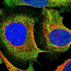 Immunofluorescent staining of human cell line U-2 OS shows localization to plasma membrane & vesicles.