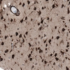 Immunohistochemical staining of human cerebral cortex shows strong cytoplasmic positivity in neurons.