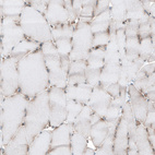 Immunohistochemical staining of human skeletal muscle shows weak cytoplasmic positivity in myocytes as expected.