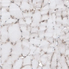 Immunohistochemical staining of human skeletal muscle shows weak cytoplasmic positivity in myocytes as expected.