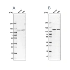 Western blot analysis using Anti-CAPRIN1 antibody HPA018126 (A) shows similar pattern to independent antibody HPA063617 (B).