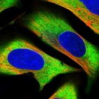 Immunofluorescent staining of human cell line U-2 OS shows localization to cytosol.