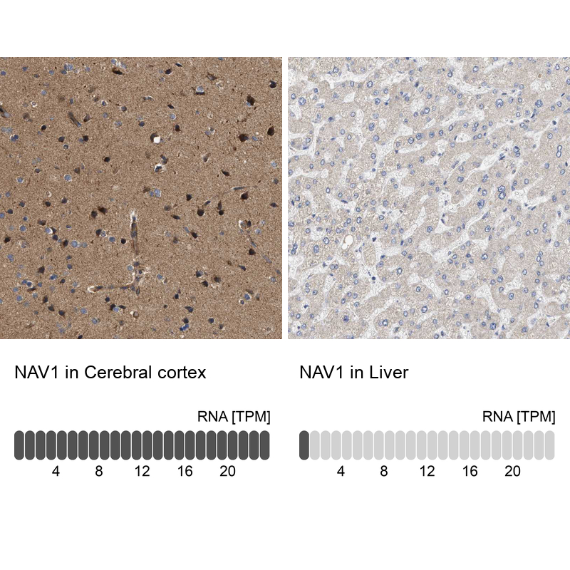 Anti-NAV1 Antibody