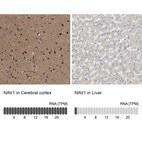 Anti-NAV1 Antibody