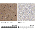 Anti-NAV1 Antibody