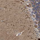 Immunohistochemical staining of human cerebellum shows strong cytoplasmic positivity in Purkinje cells.