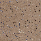Immunohistochemical staining of human cerebral cortex shows moderate cytoplasmic positivity in neuronal cells.
