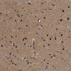 Immunohistochemical staining of human cerebral cortex shows moderate cytoplasmic positivity in neuronal cells.