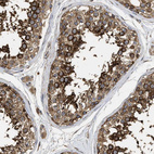 Immunohistochemical staining of human testis shows strong cytoplasmic positivity in cells in seminiferous ducts.