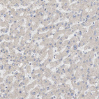 Immunohistochemical staining of human liver shows very weak cytoplasmic positivity in hepatocytes.