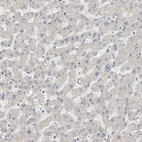 Immunohistochemical staining of human liver shows very weak cytoplasmic positivity in hepatocytes.