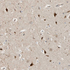 Immunohistochemical staining of human cerebral cortex shows strong cytoplasmic and nuclear positivity in neurons.