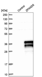 Western blot analysis in control (vector only transfected HEK293T lysate) and ZFAND5 over-expression lysate (Co-expressed with a C-terminal myc-DDK tag (~3.1 kDa) in mammalian HEK293T cells, LY416931).