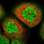 Immunofluorescent staining of human cell line A-431 shows localization to nucleoplasm & cytosol.
