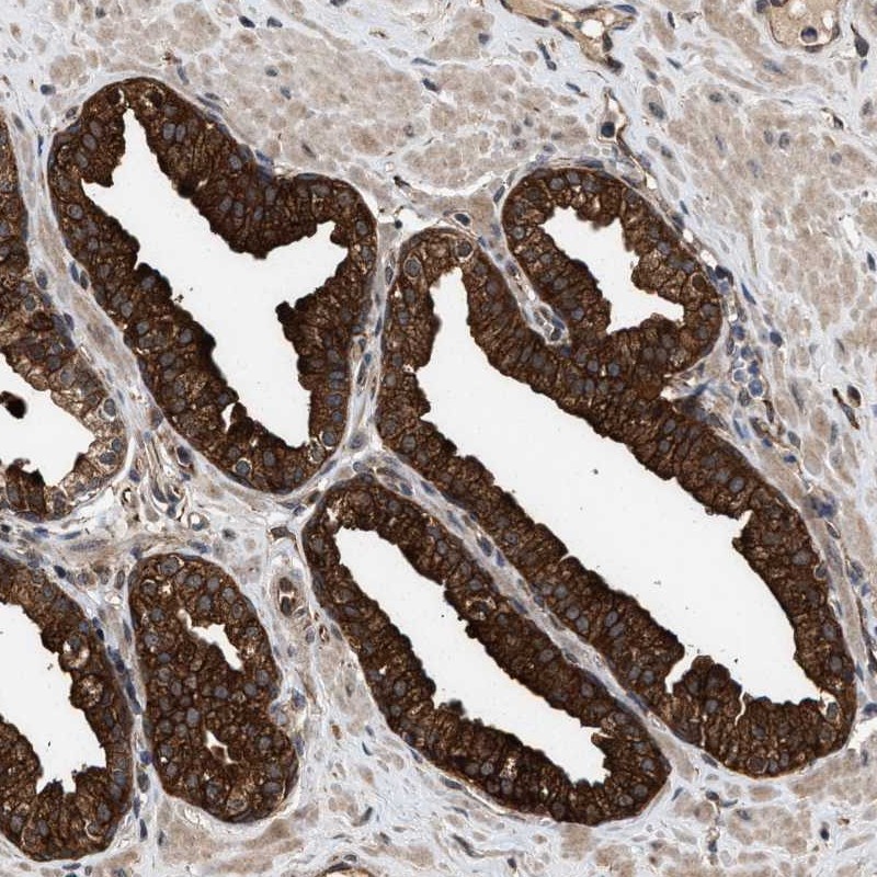 Anti-ZNHIT6 Antibody