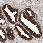 Anti-ZNHIT6 Antibody
