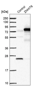 Western blot analysis in control (vector only transfected HEK293T lysate) and ZNHIT6 over-expression lysate (Co-expressed with a C-terminal myc-DDK tag (~3.1 kDa) in mammalian HEK293T cells, LY413413).