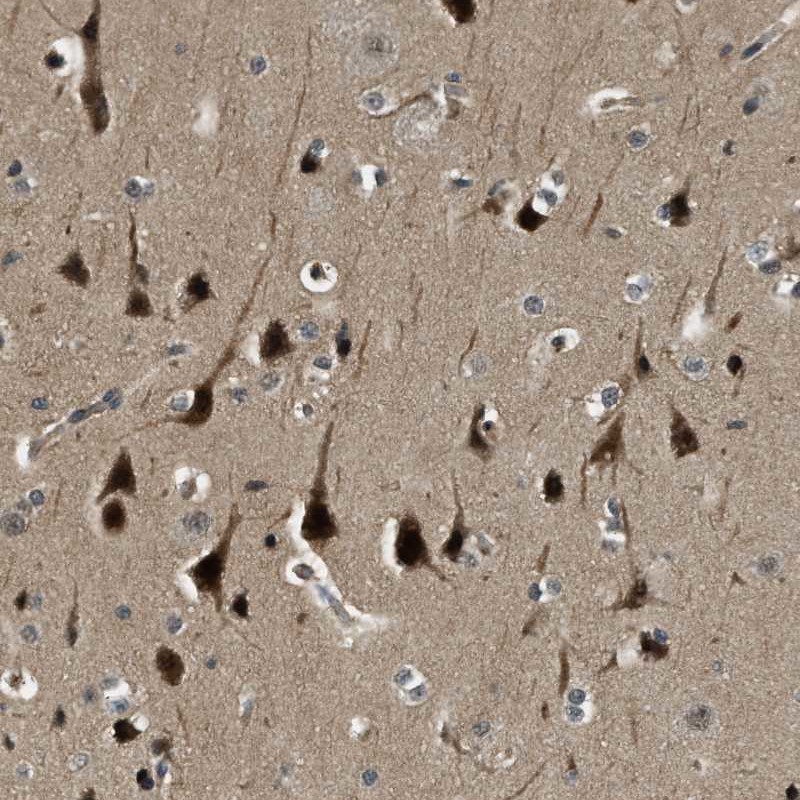 Anti-RNF141 Antibody