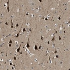 Anti-RNF141 Antibody