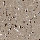 Anti-RNF141 Antibody