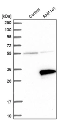 Western blot analysis in control (vector only transfected HEK293T lysate) and RNF141 over-expression lysate (Co-expressed with a C-terminal myc-DDK tag (~3.1 kDa) in mammalian HEK293T cells, LY414010).