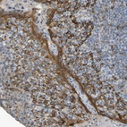 Immunohistochemical staining of human Tonsil shows strong membranous and cytoplasmic positivity in squamous epithelial cells.