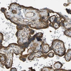 Immunohistochemical staining of human Placenta shows strong membranous and cytoplasmic positivity in trophoblastic cells.