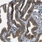 Immunohistochemical staining of human Fallopian tube shows moderate membranous and cytoplasmic positivity in glandular cells.