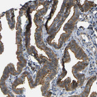 Anti-KIAA1671 Antibody