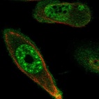Immunofluorescent staining of human cell line PC-3 shows localization to nuclear speckles & plasma membrane.