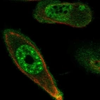 Immunofluorescent staining of human cell line PC-3 shows localization to nuclear speckles & plasma membrane.