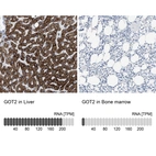 Anti-GOT2 Antibody