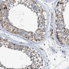 Immunohistochemical staining of human testis shows strong cytoplasmic granular positivity in cells in seminiferous ducts.