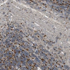 Immunohistochemical staining of human cerebellum shows strong cytoplasmic granular positivity in cells in granular layer.