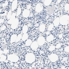 Immunohistochemical staining of human bone marrow shows no positivity in hepatocytes as expected.