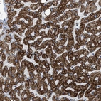 Immunohistochemical staining of human liver shows very strong cytoplasmic granular positivity in hepatocytes.