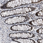 Immunohistochemical staining of human colon shows strong nuclear positivity in glandular cells.